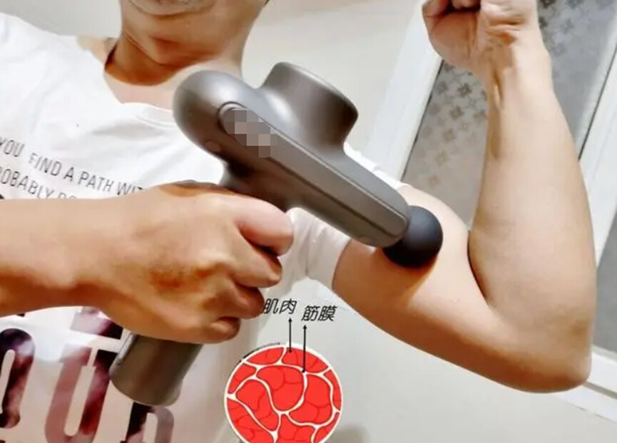 筋膜枪正确使用指南 切莫忽视这三大潜在风险